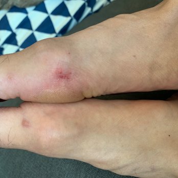 Lena Nails - Those areas are sensitive and even more with the callous remover juice. - Nail Salons Near Me - San Diego, California