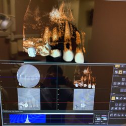 Wayne J Yee, DDS, PC - Dr Yee was trained at Memorial Sloan-Kettering & has the Latest Cone Beam technology allowing diagnosis in 3D; like MRIs used in hospitals