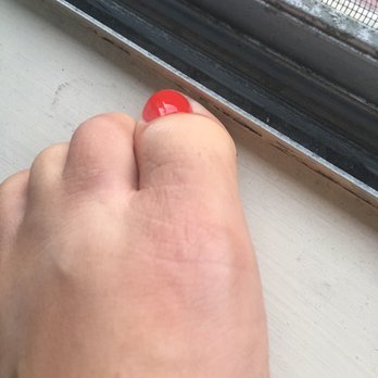 Gold Star Nails - You can see the redness from my big toe and the water bubble starting to form. - Nail Salons Near Me - Lake Forest, California Gold Star Nails - You can see the redness from my big toe and the water bubble starting to form. - Nail Salons Near Me - Lake Forest, California