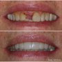 Anaheim Hills Smile Studio