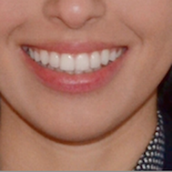 All City Dental Services - Thanks All City Dental for improving my smile and my confidence!