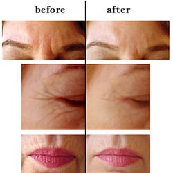 A-One Acupuncture & Herbs - FACIAL DISORDERS