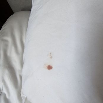 Cabana Inn & Suites - Blood on the pillowcase - Hotels Near Me - Long Beach, California Cabana Inn & Suites - Blood on the pillowcase - Hotels Near Me - Long Beach, California