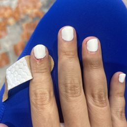 Cut cuticle