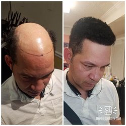 Hair Loss Center