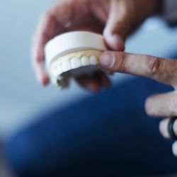 Bonita Dental Center - Smile Makeover