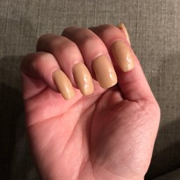 Crooked lumpy nails.
