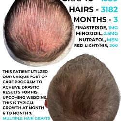 SD Hair MD