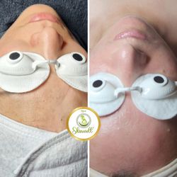 Spa Skin Well - Enhanced Illumination Facial! 
ensuring visible improvements that reduce pigmentation, soften fine lines, and revitalize dull skin.