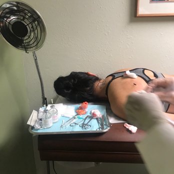 Matthew B Luxenberg, MD - Procedure of lipoma being removed - Dermatologists Near Me - Los Alamitos, California