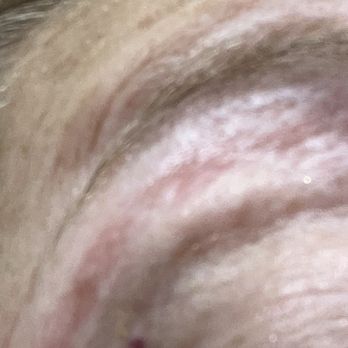 Nail Buzz 3 - Open wounds. Management and tech response was accusatory, unprofessional and rude. - Nail Salons Near Me - Port St. Lucie, Florida Nail Buzz 3 - Open wounds. Management and tech response was accusatory, unprofessional and rude. - Nail Salons Near Me - Port St. Lucie, Florida