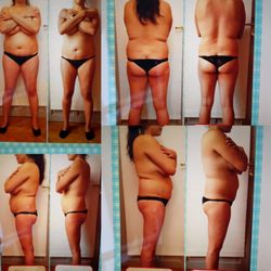 Cabinet LPG Endermocenter - Endermologie LPG Esthétique 

Silhouette affinée (1 year++)