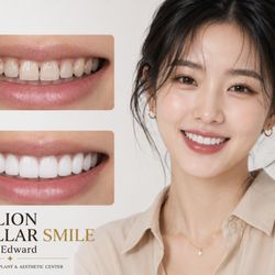 #라미네이트 #심미치과 #치아성형 #미용치과#微笑设计 #瓷贴面 #牙齿美容 #韩国风牙齿
#Veneers #SmileMakeover #CosmeticDentistry #SmileDesign