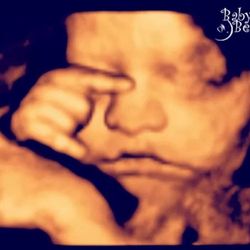 Baby in the Belly 3D/4D Ultrasound - "I Wanna Rock N Roll All Night"!