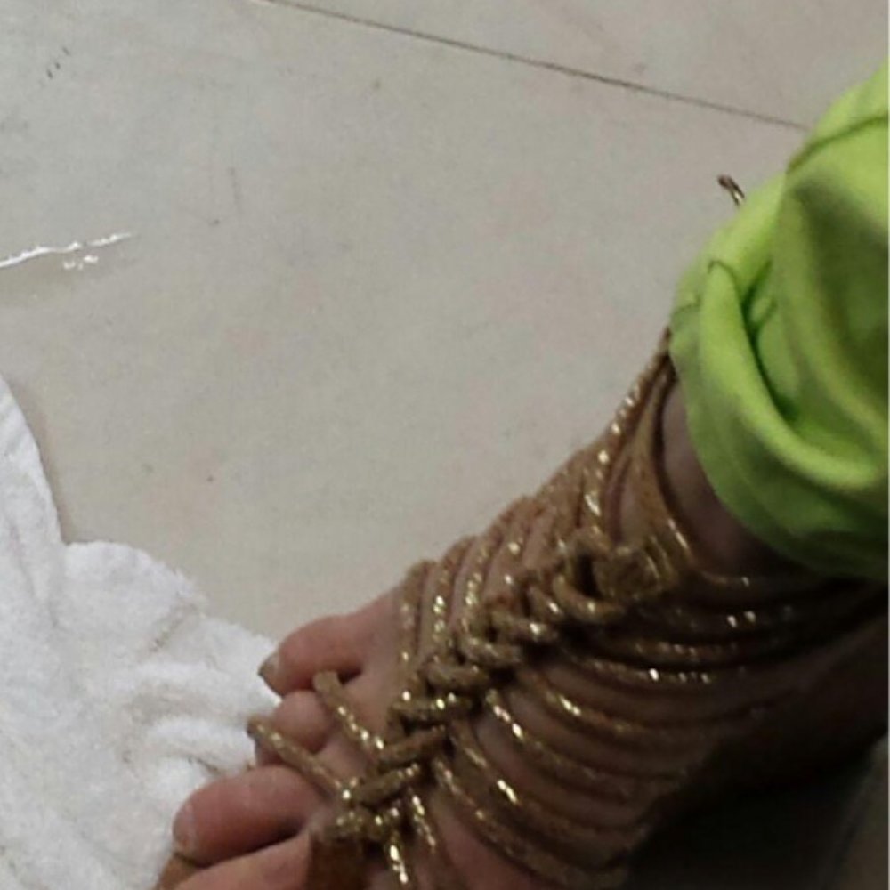 This is what your technicians toes look like This is what your technicians toes look like