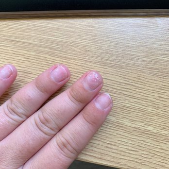 Champions Nail Bar - Thin nails - Nail Salons Near Me - Fort Worth, Texas Champions Nail Bar - Thin nails - Nail Salons Near Me - Fort Worth, Texas