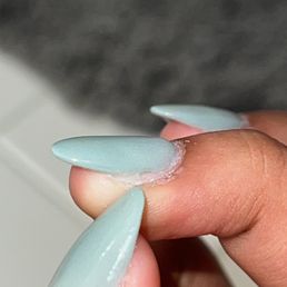 He completely missed a chunk of my nail bed.