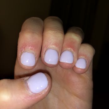 Lux 88 Nail Spa - My cuticles 2 days after the manicure, cut and irritated - Nail Salons Near Me - New York, New York Lux 88 Nail Spa - My cuticles 2 days after the manicure, cut and irritated - Nail Salons Near Me - New York, New York