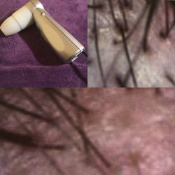 Kathys Hair Care - Get your scalp under a scope to find out why you are losing your hair and why is it thinning