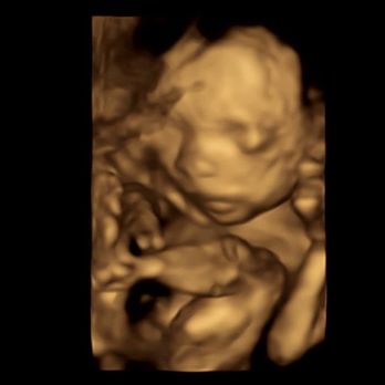 Prenatal Cinemas - Ultrasound Imaging Centers Near Me - Harbor City, California