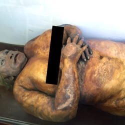 Museo de Anatomía de la Facultad de Ciencias Médicas - Museo de Anatomía de la Facultad de Ciencias Médicas de Rosario - Mujer embalsamada: Carmelita Colombo