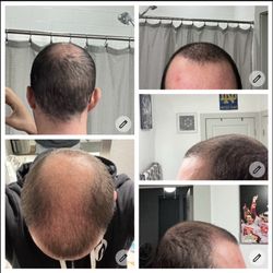 Dr Kenneth A Buchwach MD Facs - Month 1