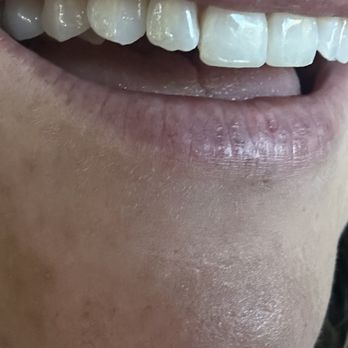 McElroy Smiles By Design of Encinitas - General Dentistry Near Me - Encinitas, California McElroy Smiles By Design of Encinitas - General Dentistry Near Me - Encinitas, California