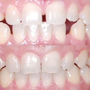 Icon Dental Smile - Invisalign - Oral Surgeons Near Me - Visalia, California Icon Dental Smile - Invisalign - Oral Surgeons Near Me - Visalia, California