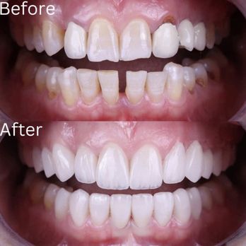 Restore Dental - Cosmetic Dentists Near Me - Los Angeles, California Restore Dental - Cosmetic Dentists Near Me - Los Angeles, California