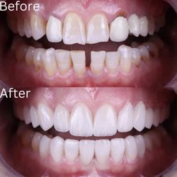 Restore Dental