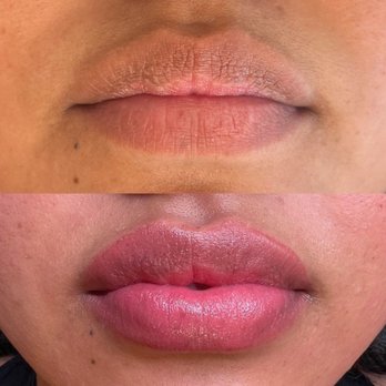 Hairy Little Things - Costa Mesa - She corrected my hyperpigmentation - Permanent Makeup Near Me - Costa Mesa, California Hairy Little Things - Costa Mesa - She corrected my hyperpigmentation - Permanent Makeup Near Me - Costa Mesa, California