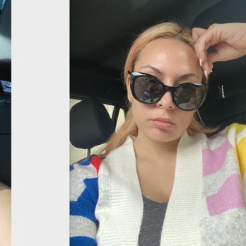 Zen Aesthetic - Before and after Thermage treatment just 2 weeks in! I feel like a new person and I love it. - Cosmetics & Beauty Supply Near Me - San Francisco, California Zen Aesthetic - Before and after Thermage treatment just 2 weeks in! I feel like a new person and I love it. - Cosmetics & Beauty Supply Near Me - San Francisco, California