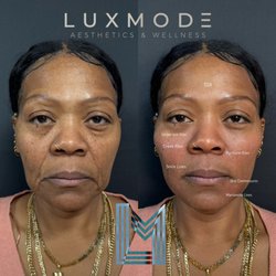 Luxmode Aesthetics & Wellness
