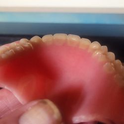 Bright Now! Dental & Orthodontics
