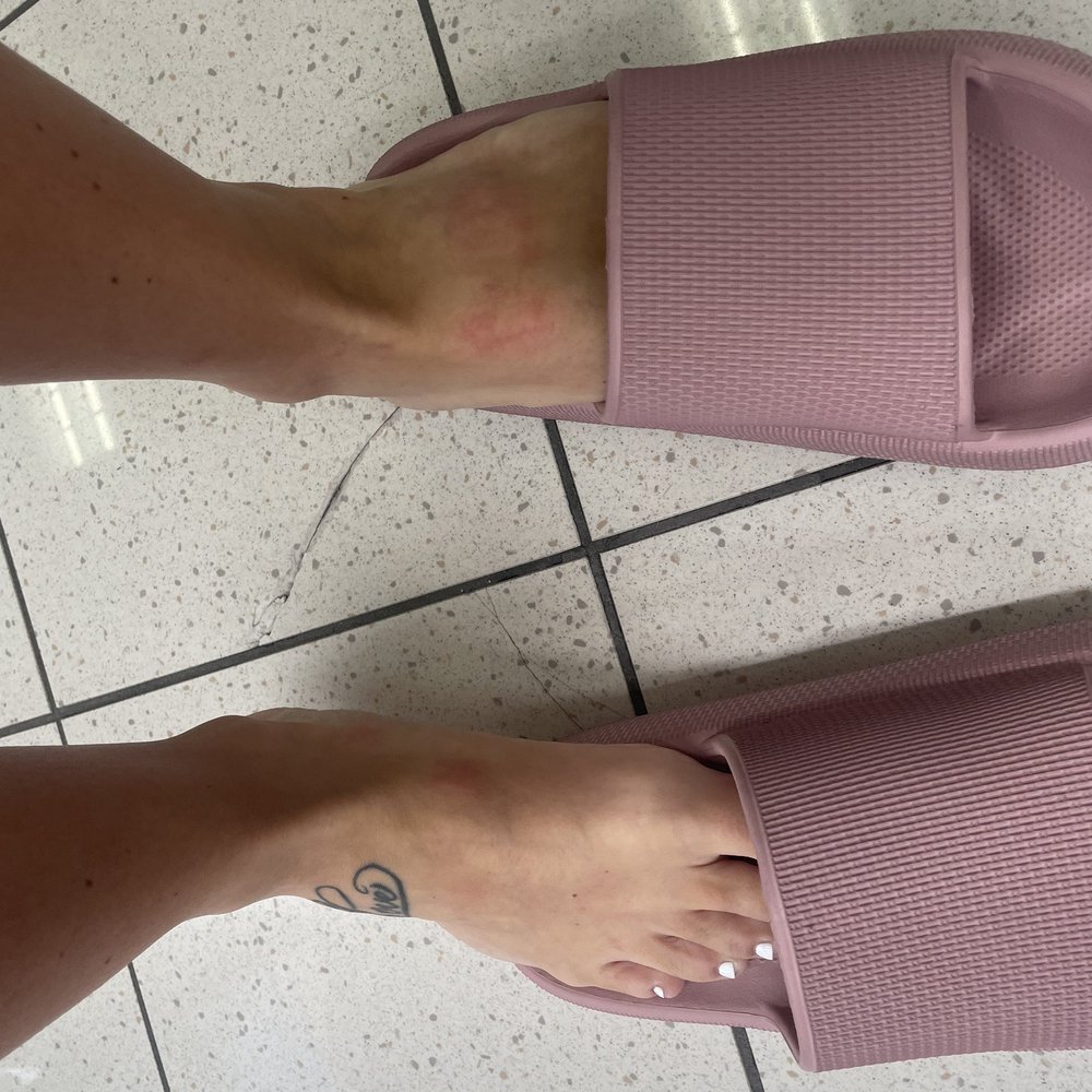 Hurt feet. Hurt feet.
