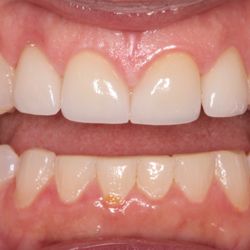 Kedzie Dental Clinic - After