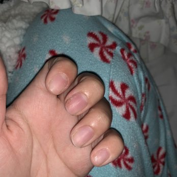 Nail Art - middle finger nail deeply cut - Nail Salons Near Me - Oakland, California