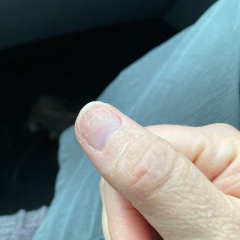 Quarry Nails - Damaged nail - Nail Salons Near Me - San Antonio, Texas Quarry Nails - Damaged nail - Nail Salons Near Me - San Antonio, Texas