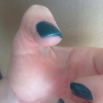 Day Nails and Spa - Cut skin, the acrylic is uneven and all over skin all complimented with nice visible brush streaks, the perfect job! - Day Spas Near Me - San Luis Obispo, California