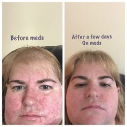 Associates In Dermatology