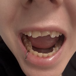 MY TEETH!!!! MY TEETH!!!!