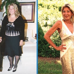 Jeremy E Korman, MD - Cedars Sinai - Robyn Lost Over 250lbs