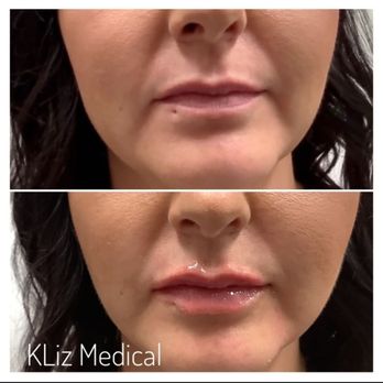 Longevity Aesthetics - Medical Spas Near Me - Rapid City, South Dakota