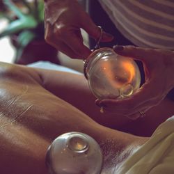 Resonance Acupuncture