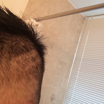 Signature Styles Salon - White lines running down my head... - Hair Salons Near Me - New York, New York