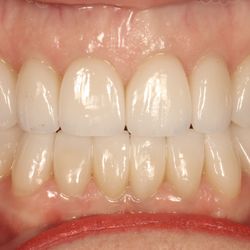 Advanced Dentistry of Amarillo