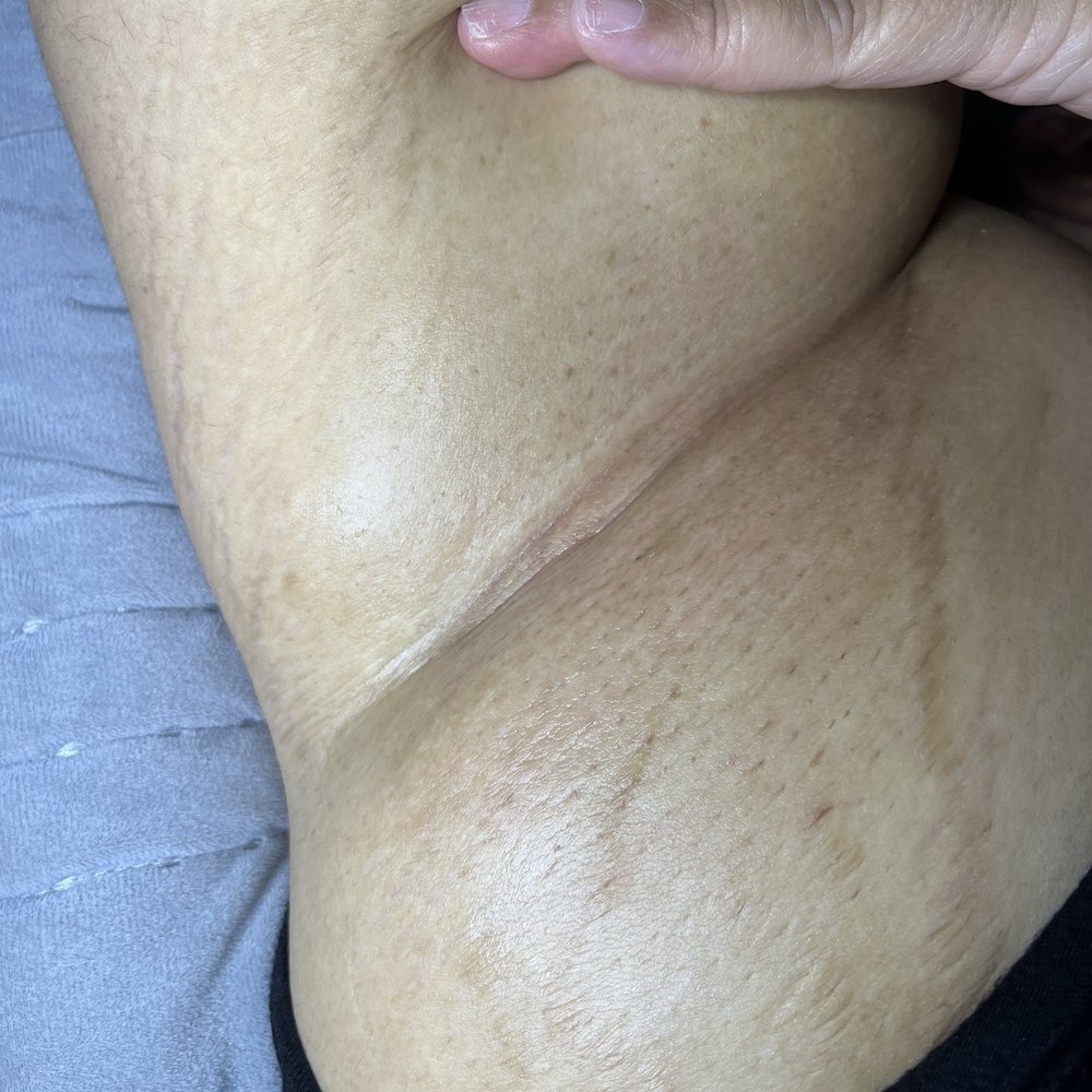 Elena G Beauty - Squeaky clean! I mean, no hair at all. - Skin Care Near Me - El Segundo, California Elena G Beauty - Squeaky clean! I mean, no hair at all. - Skin Care Near Me - El Segundo, California