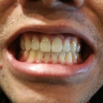 New Dental Images - After - Cosmetic Dentists Near Me - Elk Grove, California New Dental Images - After - Cosmetic Dentists Near Me - Elk Grove, California