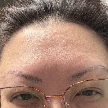 Glow&Vibe - After - Aestheticians Near Me Glow&Vibe - After - Aestheticians Near Me