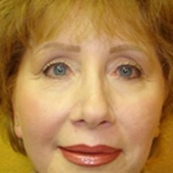 Artistry Of Permanent Makeup - Full Face procedure after healed.